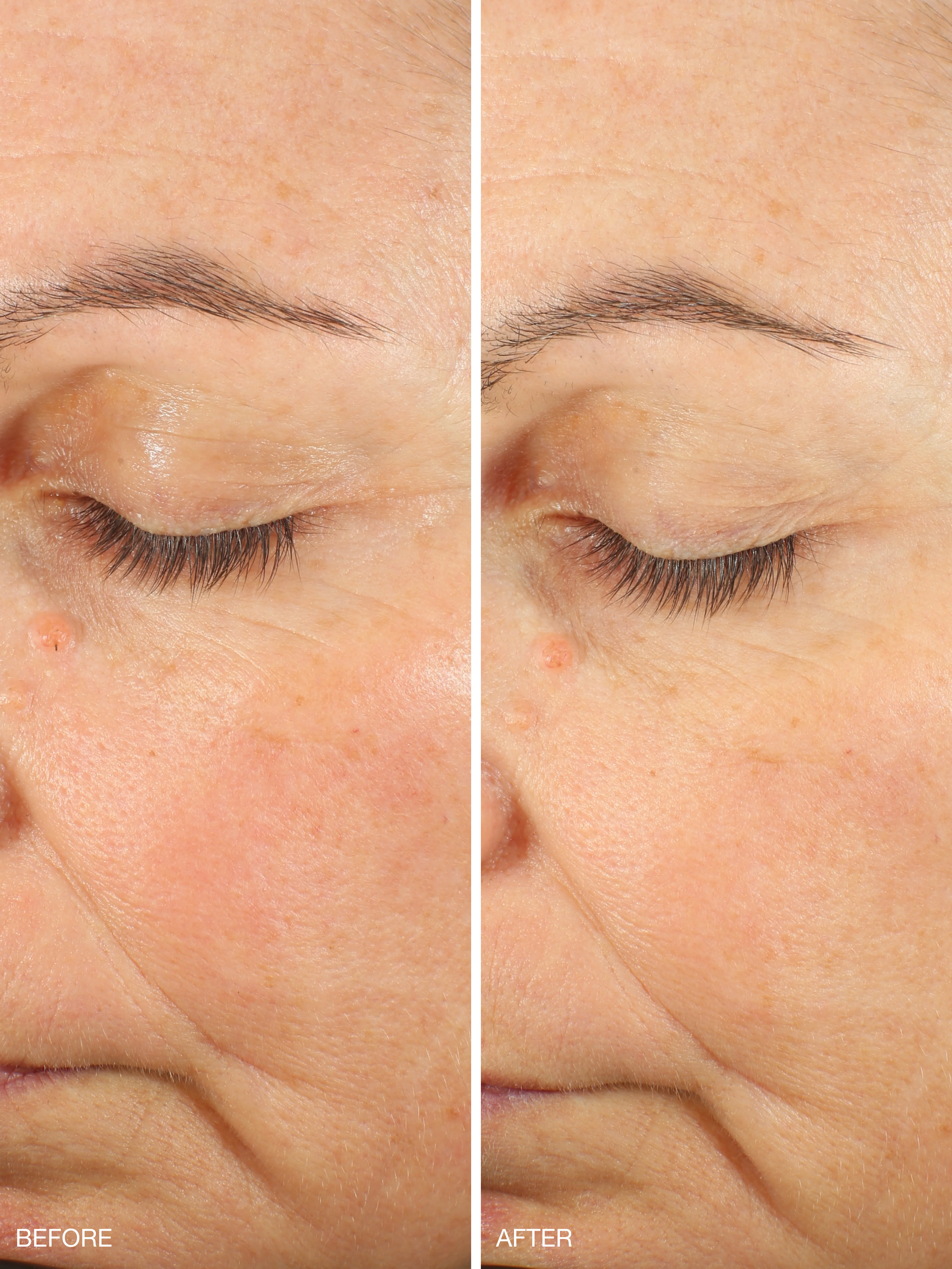 Active Collagen Wonder Serum - Image 4